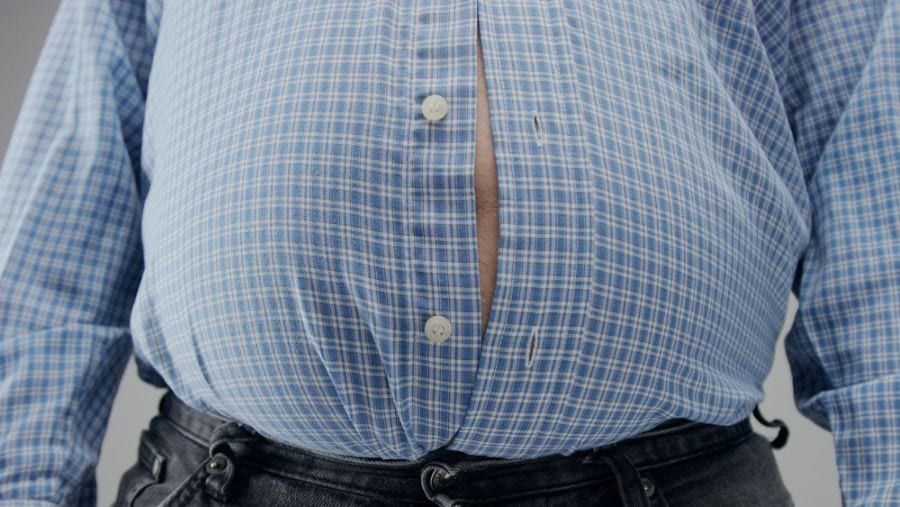 obrázek: Děčínská nemocnice získala akreditaci pro bariatrickou chirurgii